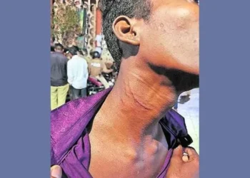 కుక్కను బెదిరించాడని.. బాలుడిపై తండ్రీకొడుకుల దాడి