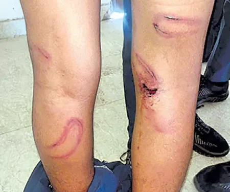 హోంవర్క్ చేయలేదని డిప్లొమా విద్యార్థులపై అధ్యాపకుడి దాడి..!