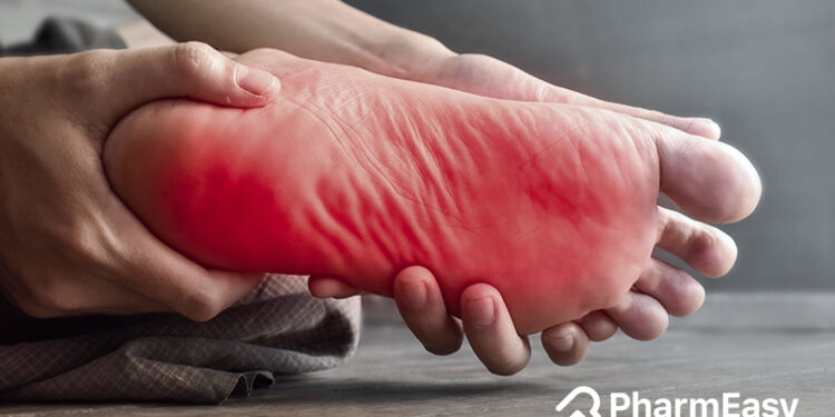 పాదాల మంటను తగ్గించే సులభ మార్గాలు