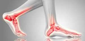 మడమ కింద నొప్పి ఎందుకు వస్తుంది?